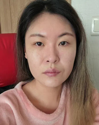 [Нүд] Чороги - Булсан давхраа, хойноос нь зүсэлт, доороос нь зүсэлт