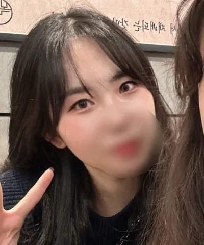 [Нүд] О쪼쪼 - Зүсэлттэй давхар зовхины дахин хагалгаа