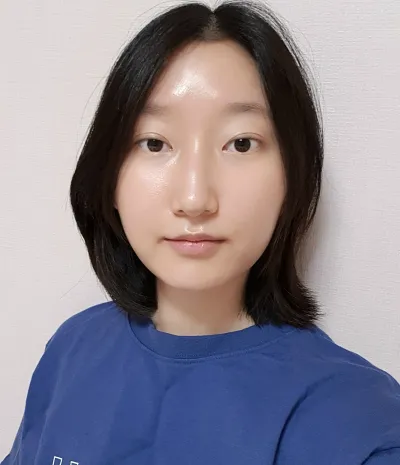 [Нүд] Өндөгний хуниас - Зүсэлттэй зовхи заслын дахин хагалгаа, доод зовхины угалз