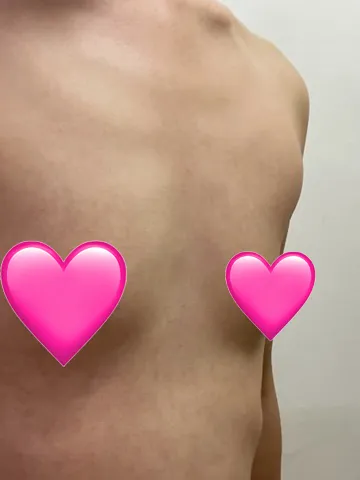 [Цээж] Дөрвөлжин цацраг - Цээж