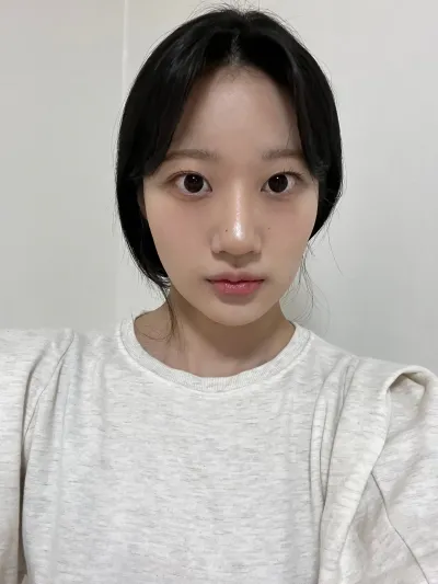 [Нүд] Даронгы - Булцуут давхраа, Зүсэлгүй зовхи засвар