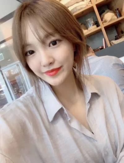 [Нүд] Нүдний мэс засал - Нүдний хэлбэр засах