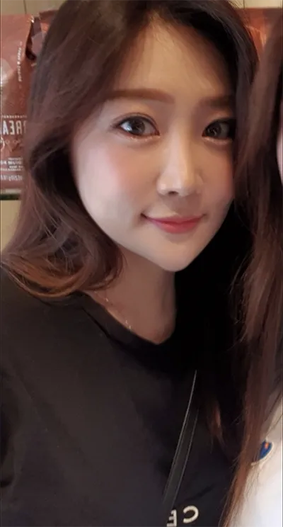 [Хамрын] Perfect - Нүд, Хамар, Өөх шилжүүлэн суулгах