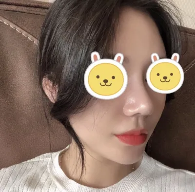 [Хамрын] Яст мэлхий хамар - Хамар