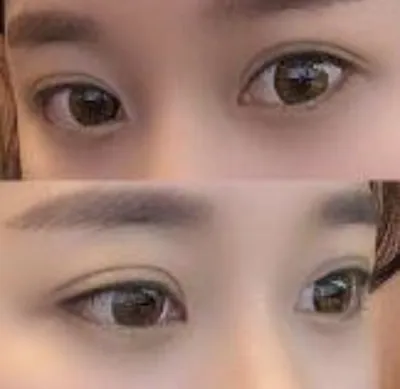 [Нүд] Цэцгийн наадамд явъя - Нүдний хэлбэр засах