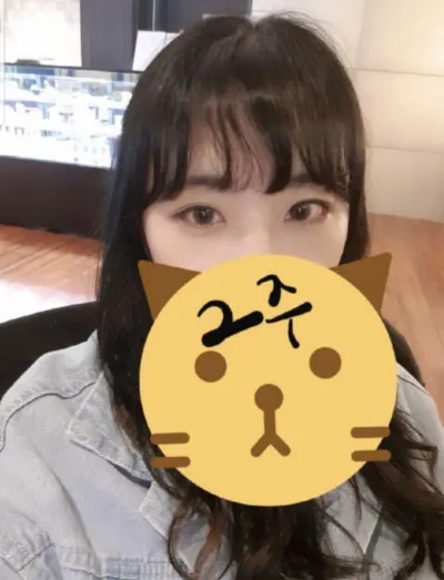 [Нүд] shshin7 - Доод зовхины тайралт, хажуугийн тайралт