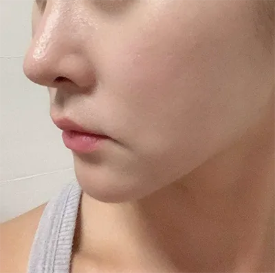 [Бяцхан] Кияхо1115 - Лифтинг