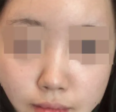 [Хамрын] Анъинүүнъонъан - Хамар