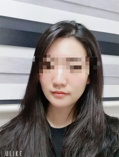 [Жижиг] [Гишүүн ngR5DA2] - Шринк, Ботокс