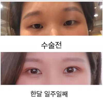 [Нүд] nalrae - Нүд