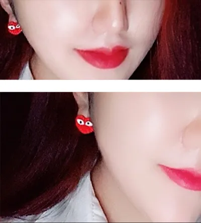 [Жижиг] Алаг эрээн сүү - Филлер, ботокс, контуржуулагч тариа