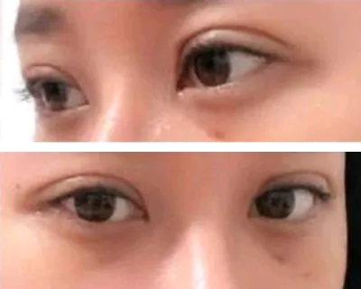 [Нүд] Романтик Три - Нүд