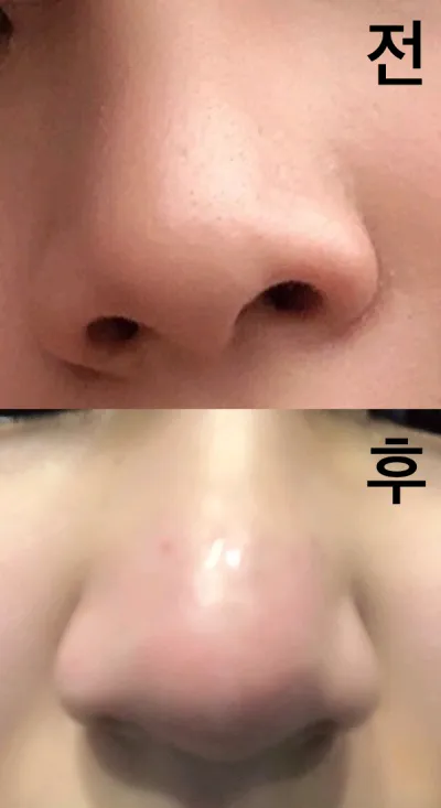 [Жижиг] Уруул - Хамрын баримал тариа