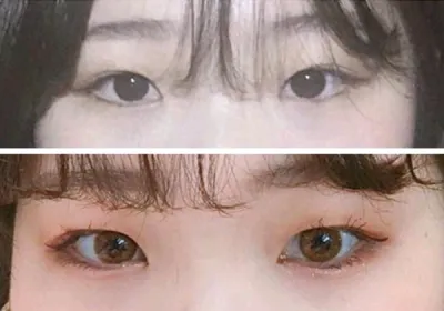 [Нүд] Үүл эгч - Нүд