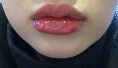 [Жижиг] Анко - Уруул