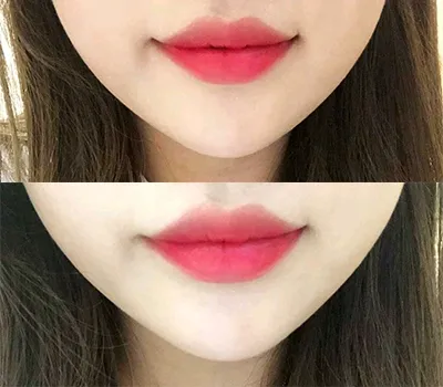 [Бяцхан] amslam - Уруулын филлер