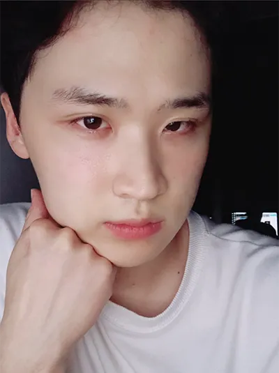 [Эрэгтэй] Гөлөг - Нүд