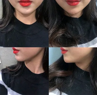 [Жижиг] Ккём-ккён - Эрүүний үзүүрийн филлер, эрүүний булчингийн ботокс