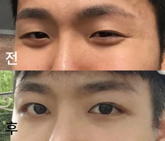 [Нүд] Чирнио - Нүд