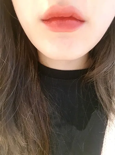 [Бяцхан] Жиддори - Уруулын филлер, ботокс