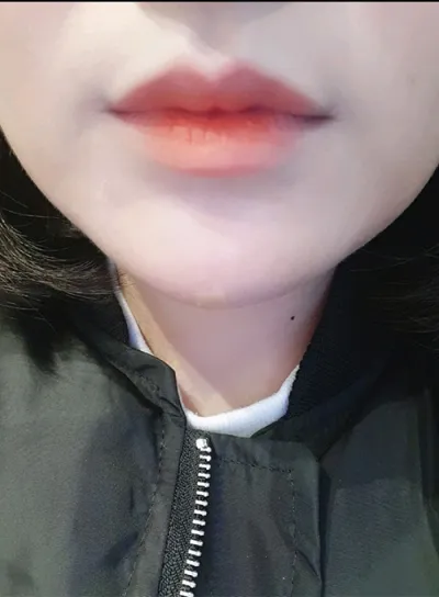 [Бяцхан] kkd0229 - Уруулын филлер