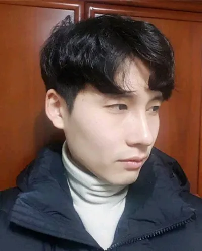 [Хамрын мэс засал] Шваник - Хамар, нүд