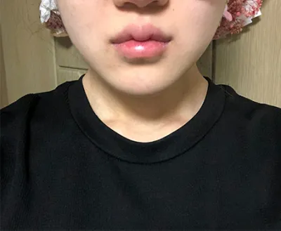 [Арьс] Пюнггюнг - Шринк