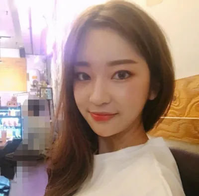 [Нүд] Мэй123 - Нүд, Өөх шилжүүлэн суулгах