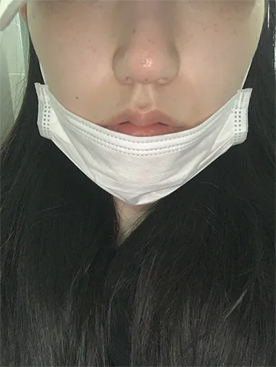 [Бяцхан] Хэтби55 - Хамар