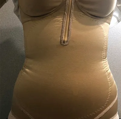 [Өөх соруулах] Од шиг нисэх - Хэвлий, шилбэний өөх соруулалт