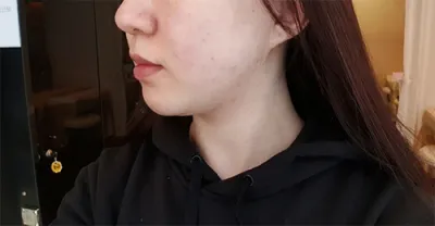 [Арьс] Широмашимаро - Шринк 400 удаагийн тариа