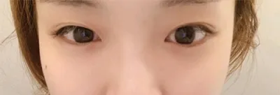 [Нүд] Пүрэнгомдори - Нүд