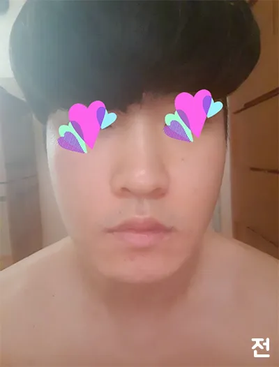 [Арьс] Ёнгижирон - Шринк