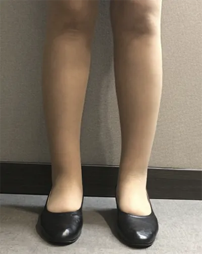 [Өөх соруулах] Од шиг нис - Шилбэ