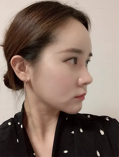 [Бяцхан] Кияхо1115 - Лифтинг