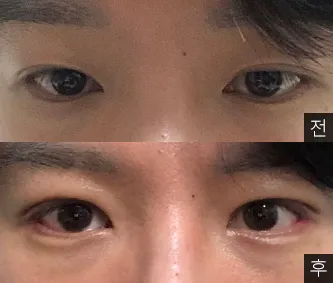 [Нүд] Чанбак - Нүд