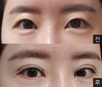 [Нүд] yahoooo - Нүд