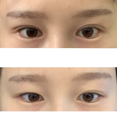 [Нүд] Туна майо - Нүд