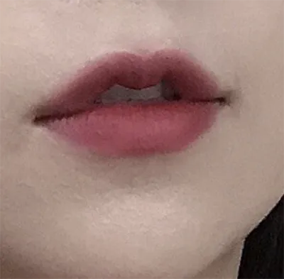 [Бяцхан] amy13 - Уруулын филлер