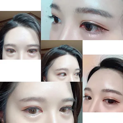 [Нүд] sjsi2 - Нүд