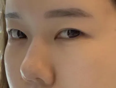 [Нүд] Гониям - Нүд, Хамар