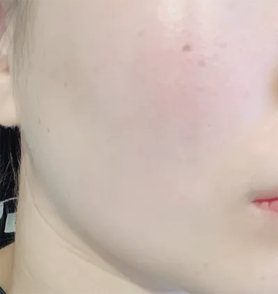 [Арьс] Шоткитоккю - Шринк