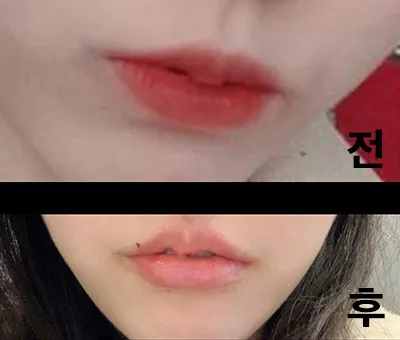 [Жижиг] Уунгваан - Уруулын филлер