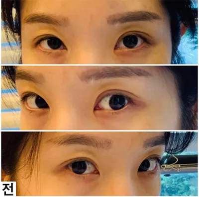 [Нүд] Ттадтанбли - Нүд