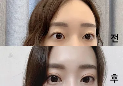 [Нүд] ski03078 - Нүд