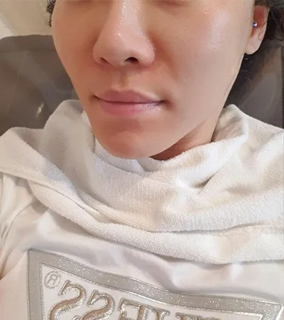 [Арьс] Бонбери - Эйр Шринк