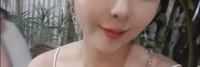 [Бяцхан] Күүкүүрүү - Уруулын филлер, утасны лифтинг