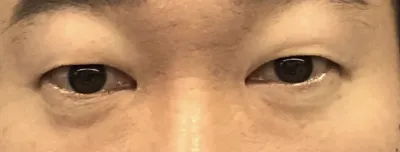 [Нүд] Будада - Нүд