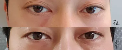 [Нүд] Тантандобли - Нүд