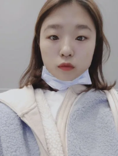 [Жижиг] Хёнхонхэн - Нүдний доод хэсэг, ботокс, филлер